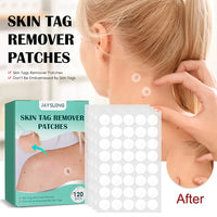 Wrattenverwijderingspleister, Hydrocolloïd Gel, Onzichtbare Stickers